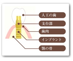 sec1_image